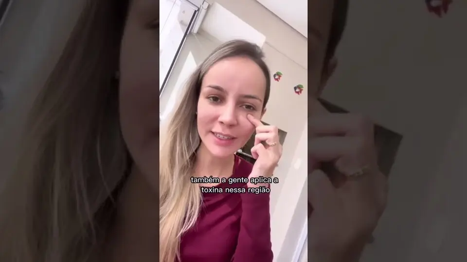 Vídeo: Aproveitei agora de manhã para atualizar minha aula sobre complicações de toxina botulínica