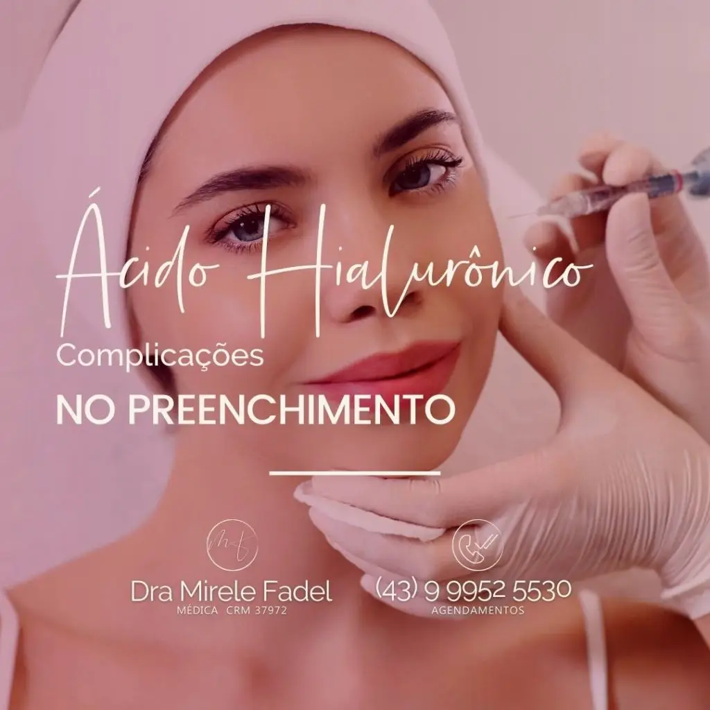 Complicações com Preenchimento de Ácido Hialurônico.