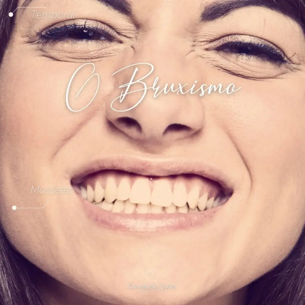 O Bruxismo e a Toxina Botulínica (Botox)