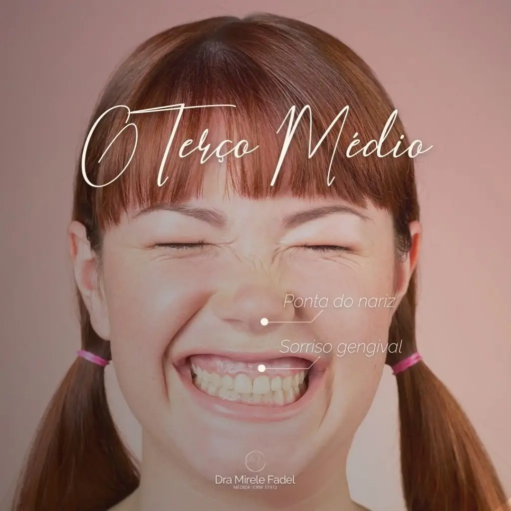 O Terço Médio da face