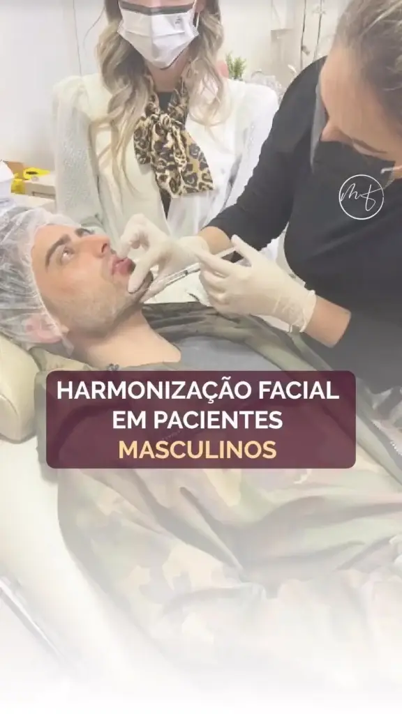 Harmonização facial em Pacientes Masculinos!