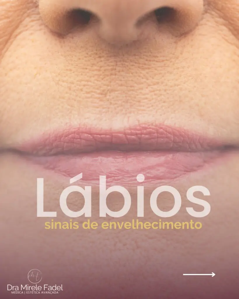 Lábios – Você percebe algum desses sinais?