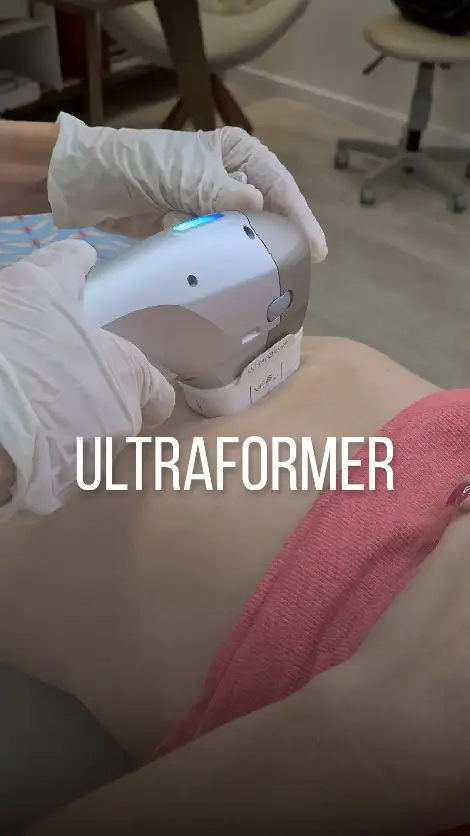 Ultraformer – Sabe aquela ‘’gordurinha’’ que não sai mesmo fazendo dieta e academia?