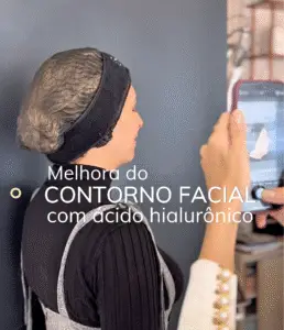 dra-mirele-fadel-contorno-facial-com-acido-hialuronico-realce-sutil-para-uma-beleza-natural