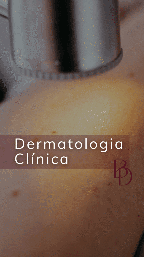 Muito além dos procedimentos estéticos, também realizo atendimentos médicos voltados para o diagnóstico e o cuidado de diferentes condições que afetam pele, cabelo e unhas. Entre elas estão: ✔️ Acne ✔️ Rosácea ✔️ Melasma ✔️ Alterações em pintas e manchas ✔️ Queda de cabelo ✔️ Alergias e outras condições dermatológicas Cada caso é avaliado de forma individualizada, com atenção técnica e cuidadosa, para que o tratamento seja seguro e adequado às necessidades de cada paciente. 📍 Se você tem alguma queixa relacionada à pele ou deseja um acompanhamento médico para manter sua saúde cutânea, nossa equipe está à disposição. #cuidedasuapele #saudedapele #acne #melasma #rosacea #quedadecabelo #dramirelefadel #beautydiscovery Este post tem caráter informativo e educacional. Os resultados relativos aos procedimentos podem variar de pessoa para pessoa. A consulta médica é indispensável para avaliação e indicação do tratamento ideal para você. Dra. Mirele Renata Fadel de Morais Teodoro | Médica CRM-PR 37972 | CRM-SP 224385