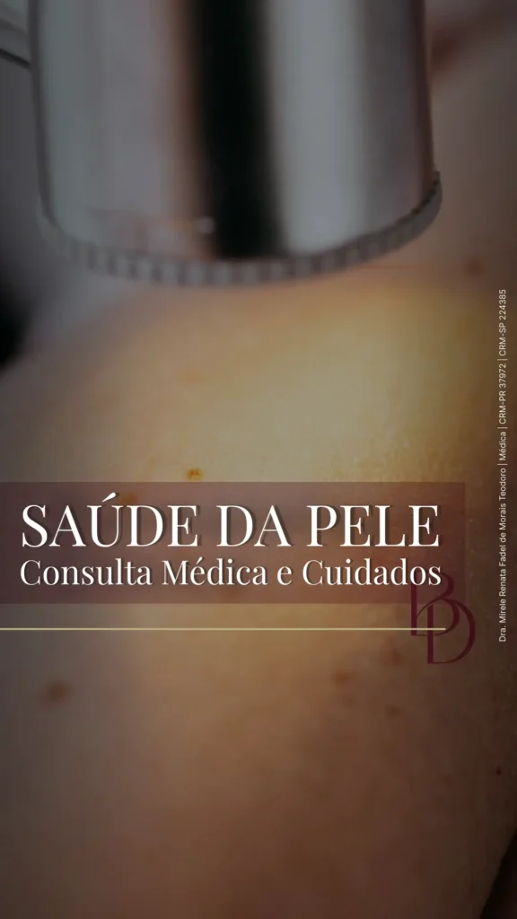 🩺 A saúde da pele vai além da estética e começa com um diagnóstico correto. Como parte da minha atuação médica, realizo a consulta focada no diagnóstico e tratamento de condições comuns da pele, cabelo e unhas. A abordagem para cada paciente é sempre individualizada. Algumas das queixas que avalio em consulta incluem: ✔️ Acne (cravos e espinhas) ✔️ Rosácea ✔️ Avaliação de manchas e pintas ✔️ Melasma (orientação e planejamento terapêutico) ✔️ Queda de cabelo ✔️ Dermatites e outras alterações da pele O objetivo da consulta médica é entender a origem do problema e, a partir daí, elaborar um plano de tratamento seguro e baseado em evidências para cuidar da sua saúde. 📍 Se você tem alguma queixa ou deseja realizar uma consulta para cuidar da saúde da sua pele, entre em contato com a equipe. #cuidadoscomapele #saudedapele #acne #melasma #rosacea #quedadecabelo #consultamedica #dramirelefadel #beautydiscovery Este post tem caráter informativo e educacional. Os resultados relativos aos procedimentos podem variar de pessoa para pessoa. A consulta médica é indispensável para avaliação e indicação do tratamento ideal para você. Dra. Mirele Renata Fadel de Morais Teodoro | Médica CRM-PR 37972 | CRM-SP 224385