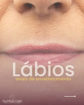 Lábios – Você percebe algum desses sinais?