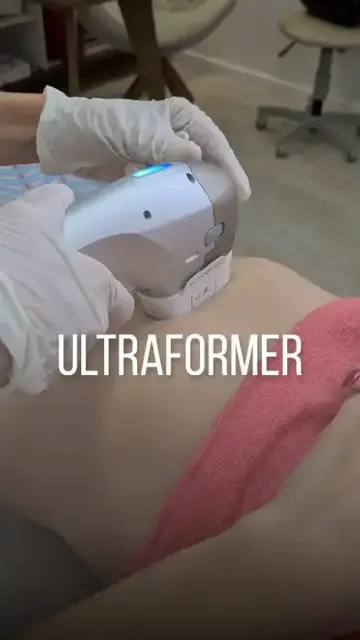 Ultraformer – Sabe aquela ‘’gordurinha’’ que não sai mesmo fazendo dieta e academia?